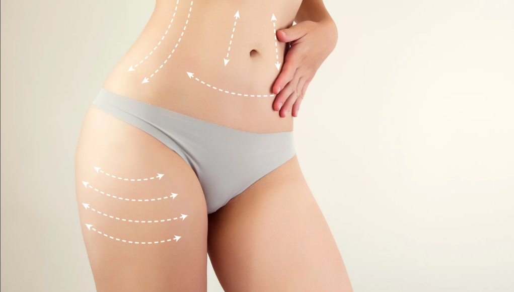 Best Liposuction Surgery Cost in Dubai