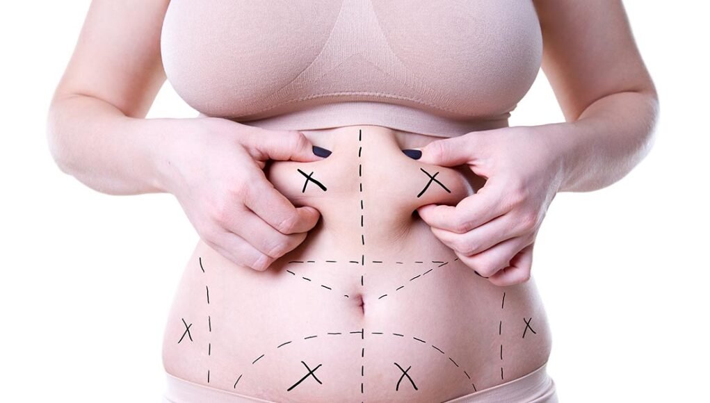 Long-Lasting Results: Dubai’s Best Fat Transfer Surgeons Share Their Techniques