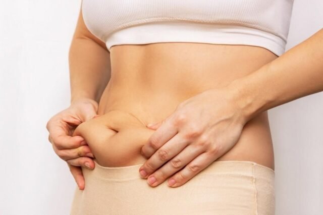 Liposuction in Dubai